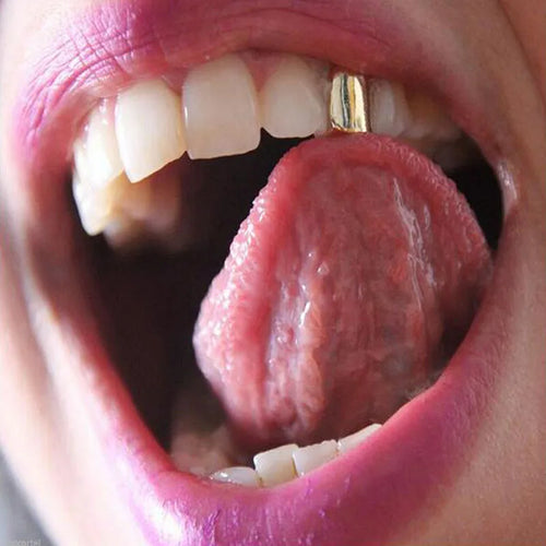 1PC Small Single Tooth Cap Hip Hop Teeth Grill Gold/Silver/Rose Gold/Black Small Metal Men 1 Pc Gold/Silver/Rose Gold/Black